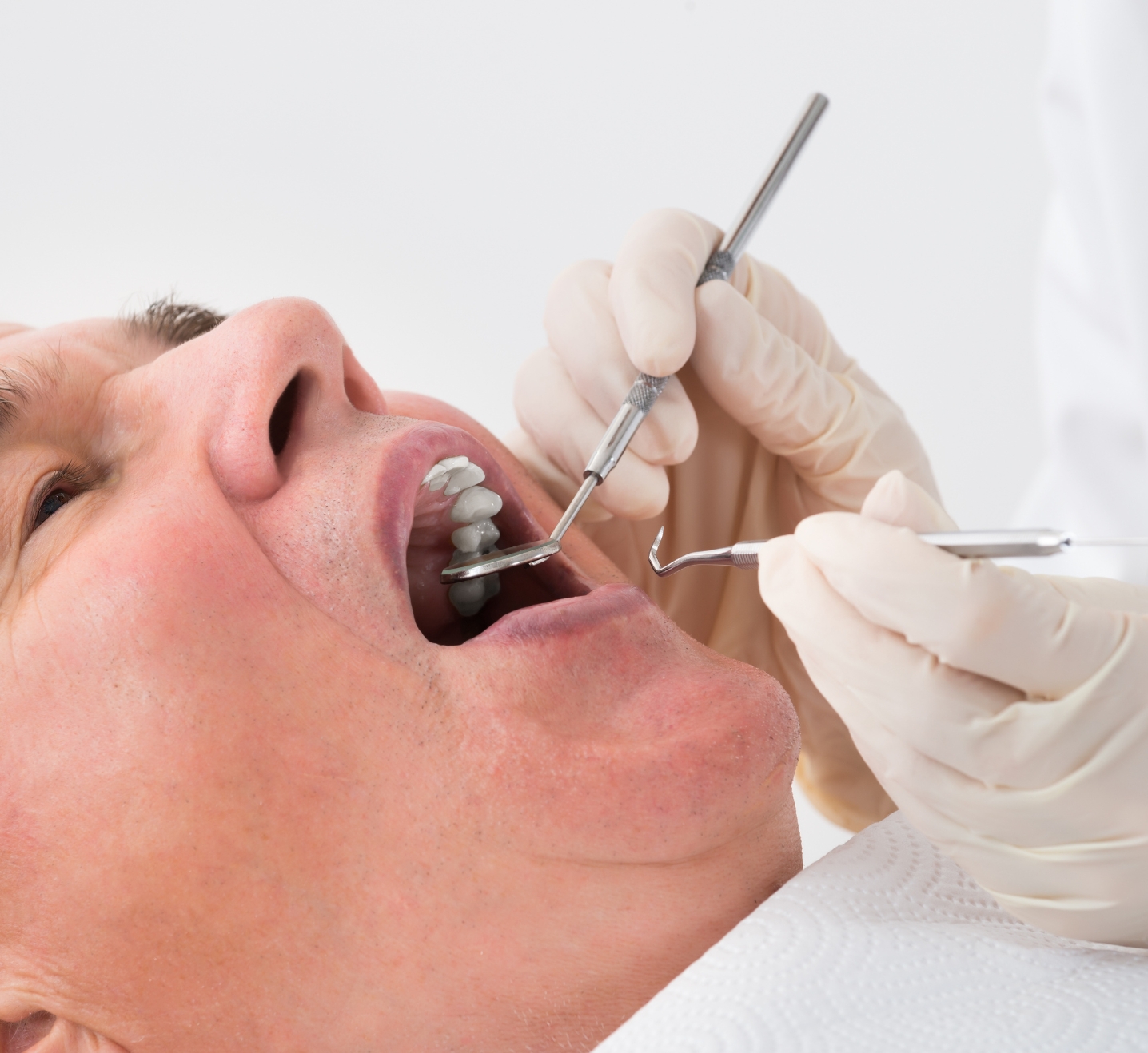 Oral rehabilitation